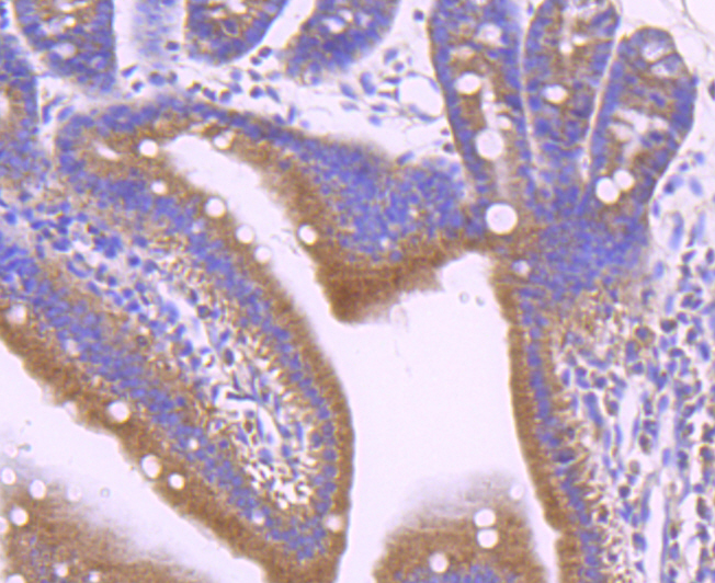 Leptin Receptor Rabbit mAb