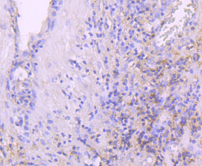 Leptin Receptor Rabbit mAb