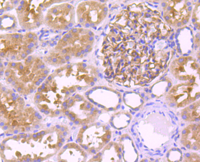 Leptin Receptor Rabbit mAb