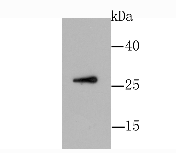 GDNF Rabbit mAb