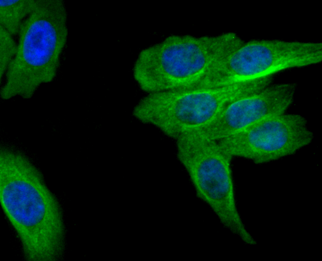 MRP2 Rabbit mAb