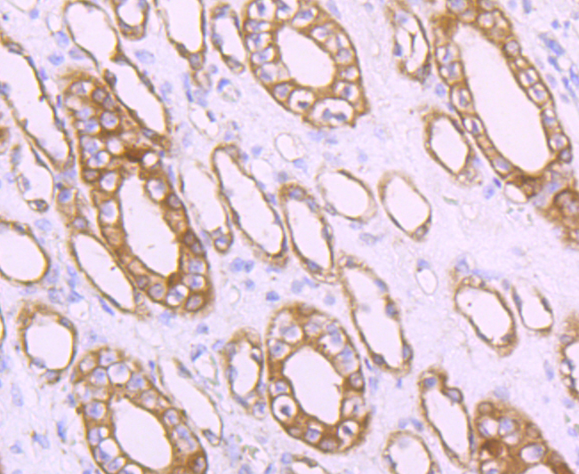 MRP2 Rabbit mAb