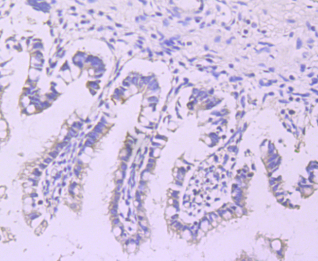 Lipoprotein lipase Rabbit mAb