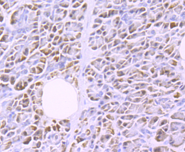 Lipoprotein lipase Rabbit mAb