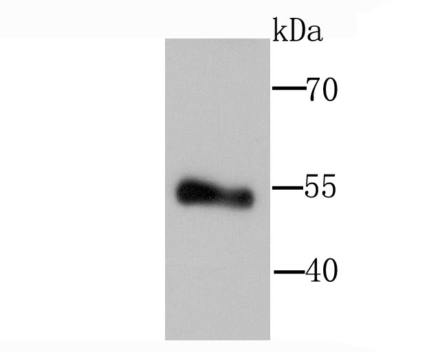 Lipoprotein lipase Rabbit mAb