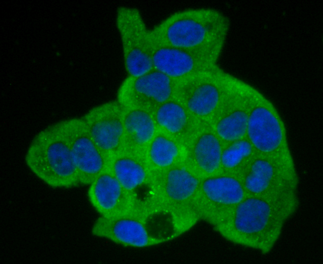 Annexin A2 Rabbit mAb