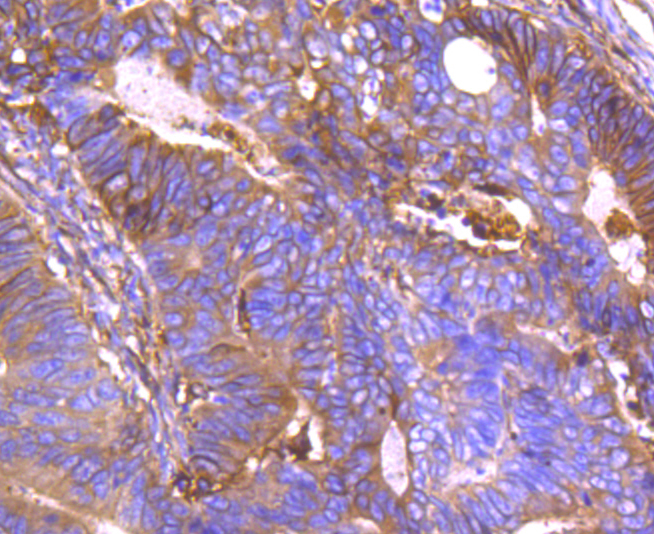 Annexin A2 Rabbit mAb