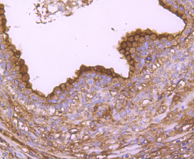 Annexin A2 Rabbit mAb