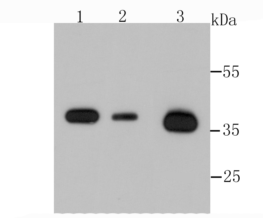 Annexin A2 Rabbit mAb