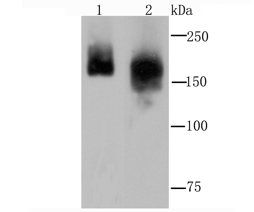 Clathrin heavy chain Rabbit mAb