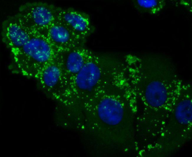 LXR alpha Rabbit mAb