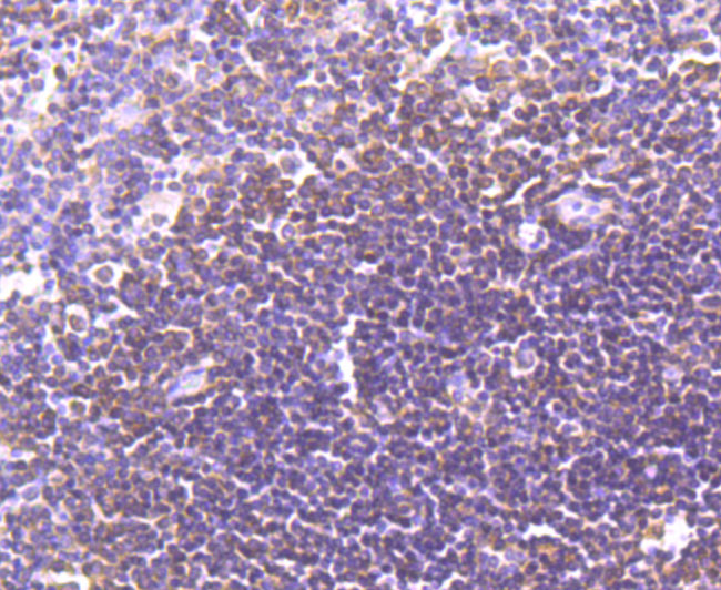 LXR alpha Rabbit mAb