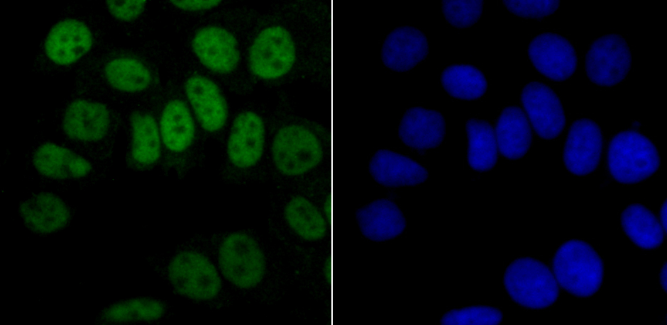 hnRNP A1 Rabbit mAb