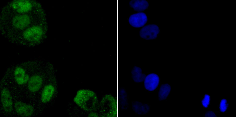 hnRNP A1 Rabbit mAb