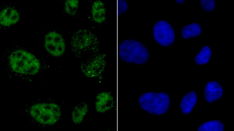 hnRNP A1 Rabbit mAb