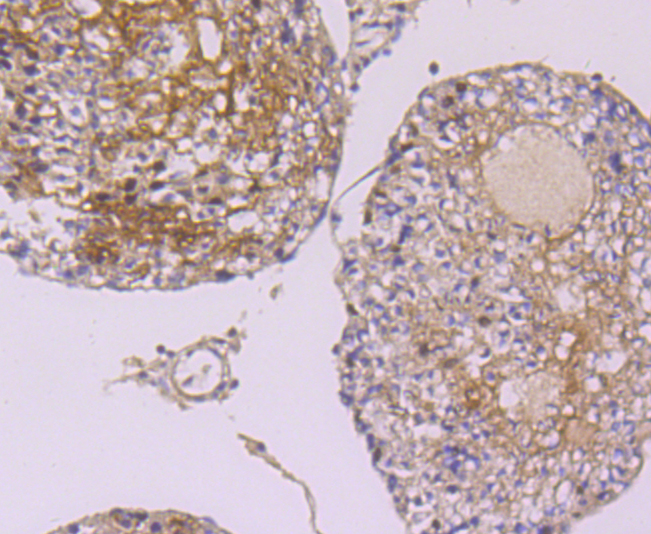 hnRNP A1 Rabbit mAb