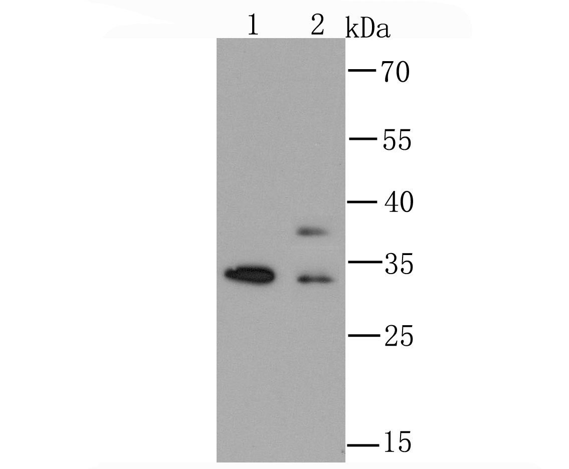 hnRNP A1 Rabbit mAb