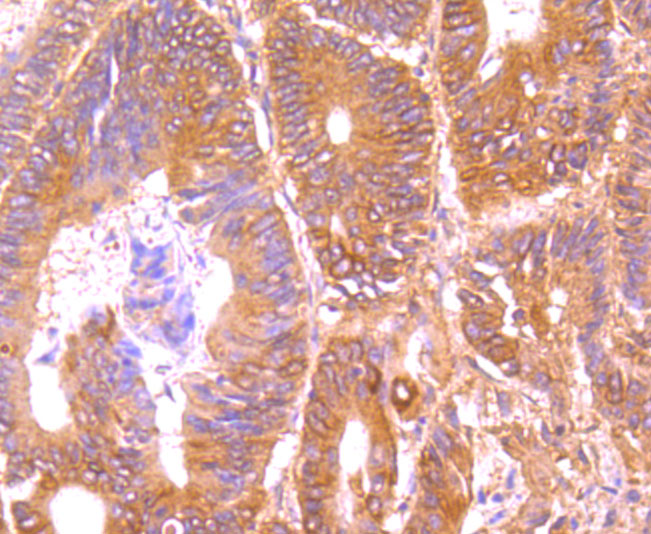 DR5 Rabbit mAb