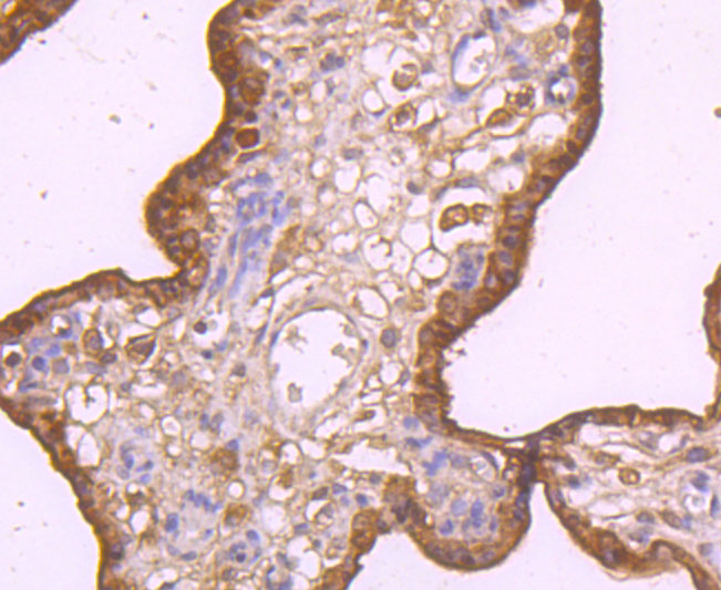 DR5 Rabbit mAb