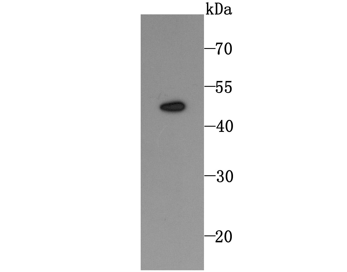 DR5 Rabbit mAb