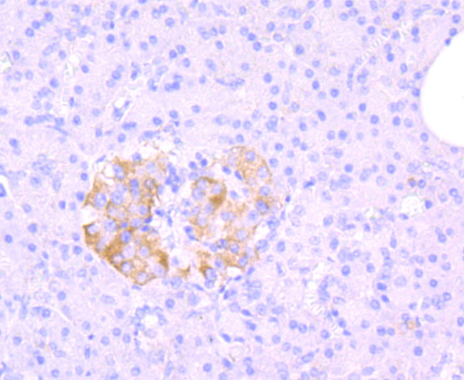 MRP1 Rabbit mAb