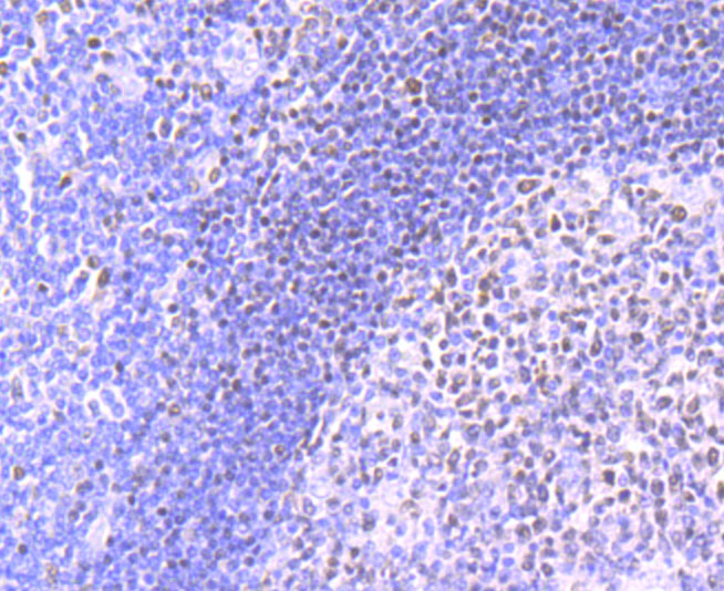 MEF2A Rabbit mAb