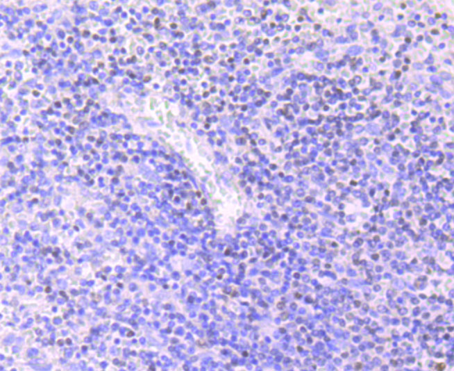 MEF2A Rabbit mAb