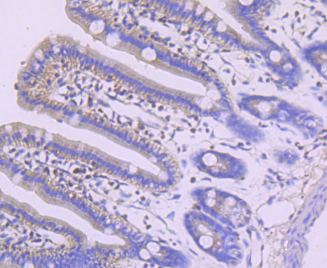 MEF2A Rabbit mAb