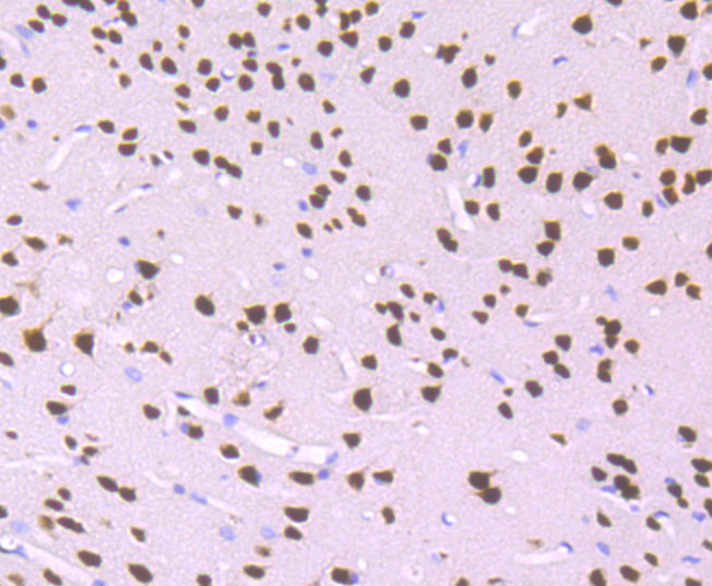 MEF2A Rabbit mAb