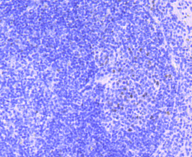 MEF2A Rabbit mAb