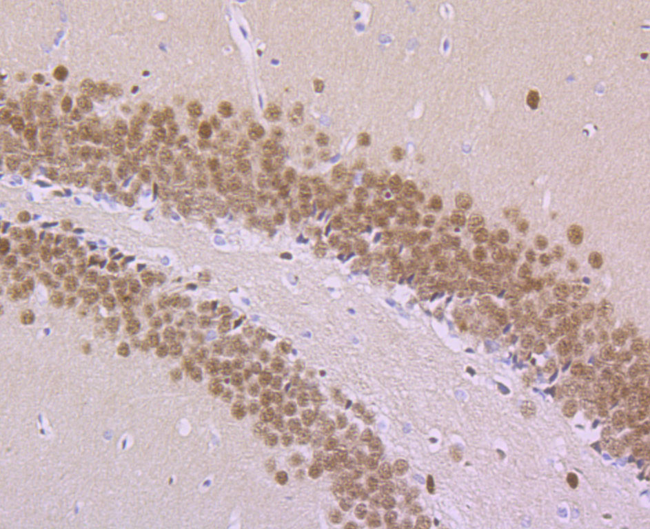 MEF2A Rabbit mAb