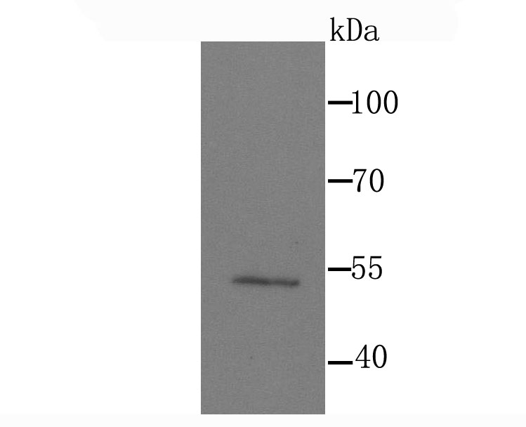 MEF2A Rabbit mAb