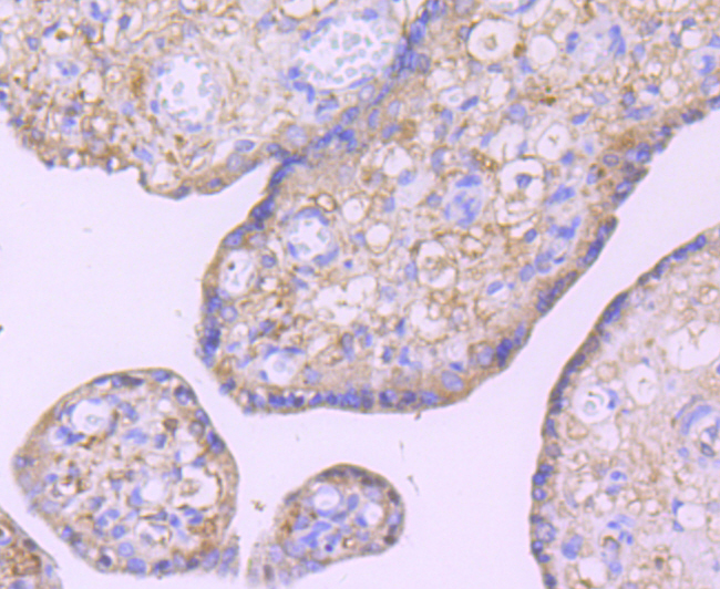 Glucose Transporter GLUT3 Rabbit mAb