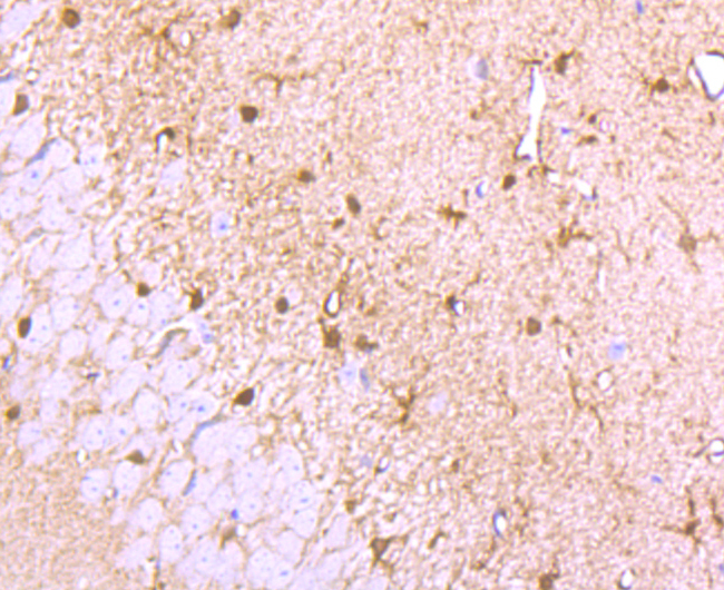 Glucose Transporter GLUT3 Rabbit mAb