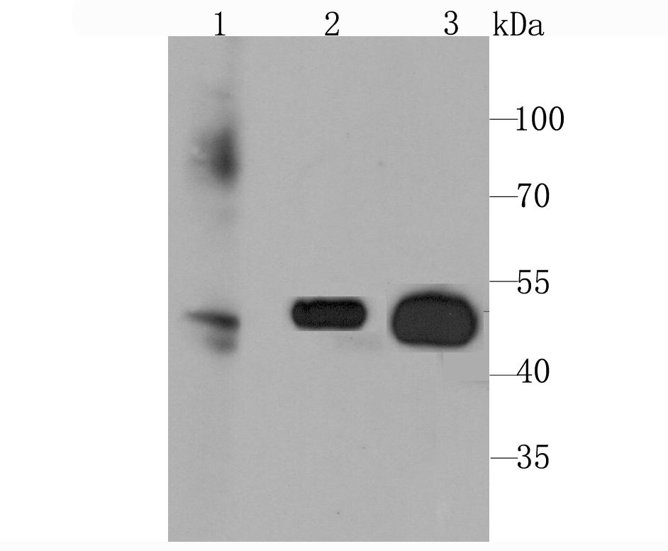 Glucose Transporter GLUT3 Rabbit mAb