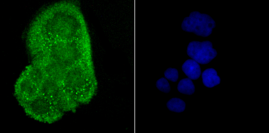 Alpha B Crystallin Rabbit mAb