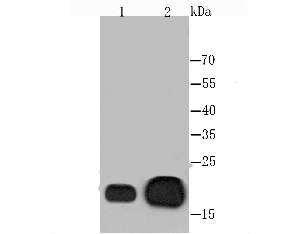 Alpha B Crystallin Rabbit mAb