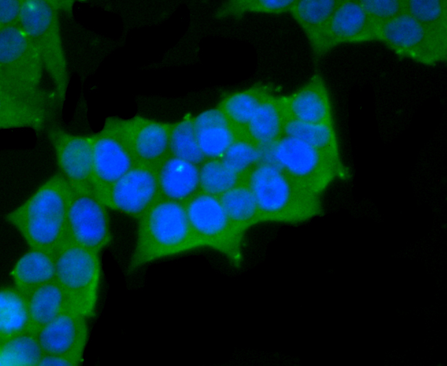 smooth muscle Myosin heavy chain 11 Rabbit mAb