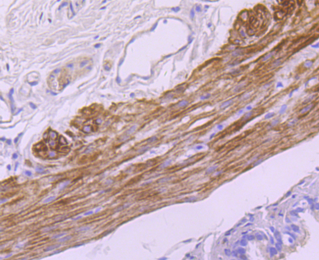 smooth muscle Myosin heavy chain 11 Rabbit mAb