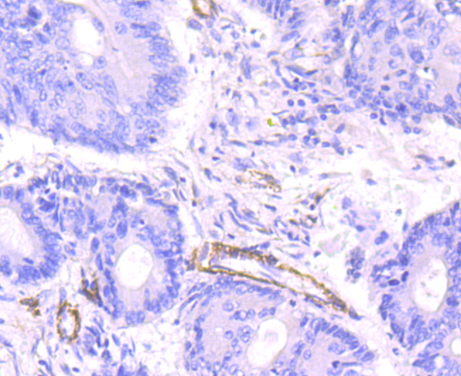 smooth muscle Myosin heavy chain 11 Rabbit mAb