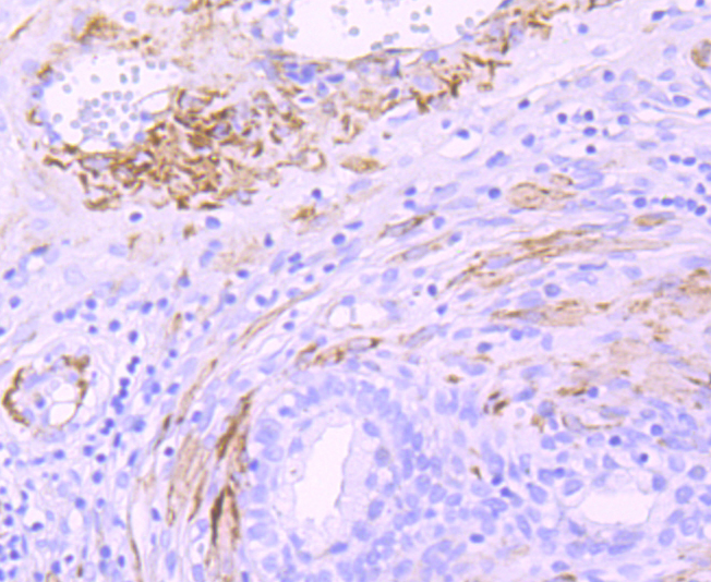 smooth muscle Myosin heavy chain 11 Rabbit mAb