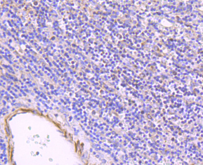 ULK1 Rabbit mAb