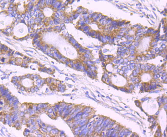 ULK1 Rabbit mAb