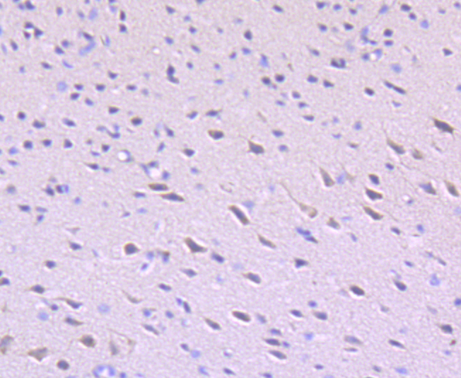 ULK1 Rabbit mAb