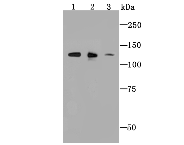 ULK1 Rabbit mAb