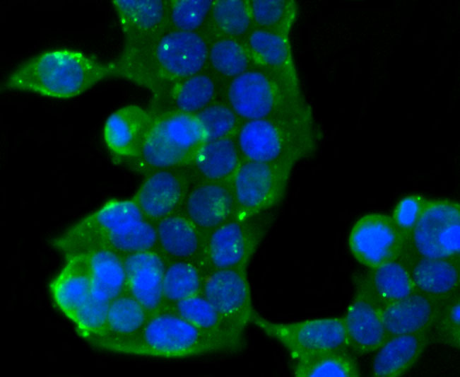 GOLPH2 Rabbit mAb