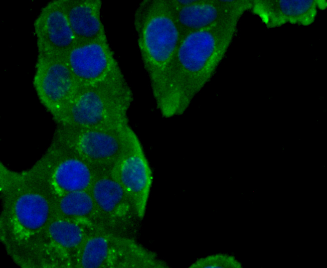 GOLPH2 Rabbit mAb