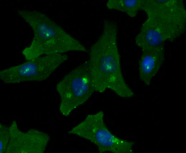 GOLPH2 Rabbit mAb