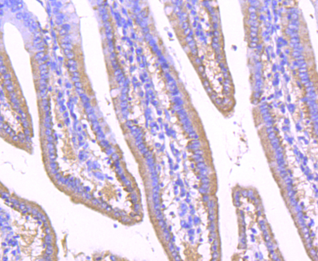 GOLPH2 Rabbit mAb