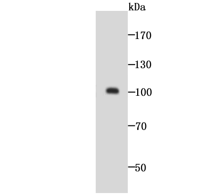 GOLPH2 Rabbit mAb